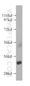 Non-Homologous End Joining Factor 1 antibody, 11888-1-AP, Proteintech Group, Western Blot image 
