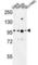 BAF Chromatin Remodeling Complex Subunit BCL11A antibody, abx034450, Abbexa, Western Blot image 