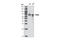Protein Inhibitor Of Activated STAT 4 antibody, 4392S, Cell Signaling Technology, Western Blot image 