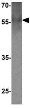 E2F Transcription Factor 3 antibody, GTX31589, GeneTex, Western Blot image 