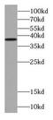 Translocase Of Outer Mitochondrial Membrane 40 antibody, FNab08860, FineTest, Western Blot image 