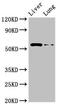 CCZ1 Homolog, Vacuolar Protein Trafficking And Biogenesis Associated antibody, LS-C677425, Lifespan Biosciences, Western Blot image 