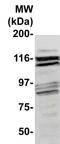 Intercellular Adhesion Molecule 1 antibody, TA354412, Origene, Western Blot image 