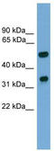 Forkhead Box A3 antibody, TA341776, Origene, Western Blot image 