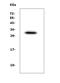 Carbonyl Reductase 1 antibody, A02825-1, Boster Biological Technology, Western Blot image 