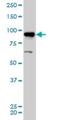 A-Kinase Anchoring Protein 8 antibody, H00010270-M01, Novus Biologicals, Western Blot image 