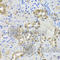 Janus Kinase 2 antibody, A7694, ABclonal Technology, Immunohistochemistry paraffin image 