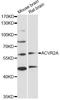 Activin receptor type IIA antibody, A1981, ABclonal Technology, Western Blot image 