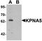 Karyopherin Subunit Alpha 5 antibody, orb178883, Biorbyt, Western Blot image 