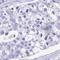 Family With Sequence Similarity 170 Member A antibody, NBP2-32707, Novus Biologicals, Immunohistochemistry frozen image 