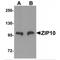 Zinc transporter ZIP10 antibody, MBS151019, MyBioSource, Western Blot image 