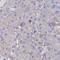 Calmodulin Like 3 antibody, HPA044999, Atlas Antibodies, Immunohistochemistry frozen image 