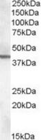 Abhydrolase Domain Containing 12 antibody, NBP1-20875, Novus Biologicals, Western Blot image 