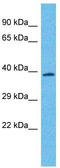 Olfactory Receptor Family 4 Subfamily N Member 2 antibody, TA337513, Origene, Western Blot image 