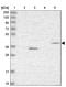 F-Box And Leucine Rich Repeat Protein 20 antibody, NBP2-47458, Novus Biologicals, Western Blot image 