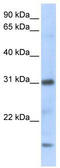 C-X-C motif chemokine 16 antibody, TA346139, Origene, Western Blot image 