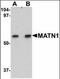 Matrilin 1 antibody, orb94279, Biorbyt, Western Blot image 