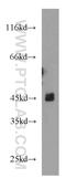 Potassium Voltage-Gated Channel Subfamily J Member 6 antibody, 21647-1-AP, Proteintech Group, Western Blot image 