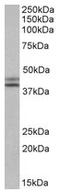 Isocitrate Dehydrogenase (NADP(+)) 1, Cytosolic antibody, AP22441PU-N, Origene, Western Blot image 