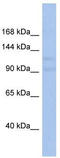Vacuolar protein sorting-associated protein 54 antibody, TA335555, Origene, Western Blot image 
