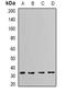 Capping Actin Protein Of Muscle Z-Line Subunit Alpha 2 antibody, orb340817, Biorbyt, Western Blot image 