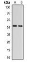 RAD23 Homolog A, Nucleotide Excision Repair Protein antibody, orb412163, Biorbyt, Western Blot image 