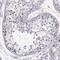 MAGE Family Member C1 antibody, NBP1-85397, Novus Biologicals, Immunohistochemistry frozen image 