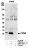 Prdx6 antibody, A305-339A, Bethyl Labs, Immunoprecipitation image 