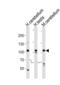 SKI Family Transcriptional Corepressor 2 antibody, MBS9204741, MyBioSource, Western Blot image 