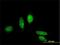 Metastasis Associated 1 Family Member 3 antibody, H00057504-M02, Novus Biologicals, Immunofluorescence image 