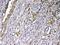 GC Vitamin D Binding Protein antibody, A03364-1, Boster Biological Technology, Immunohistochemistry paraffin image 