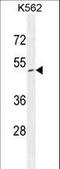 Zinc Finger Protein 517 antibody, LS-C160893, Lifespan Biosciences, Western Blot image 