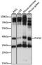 PHD Finger Protein 10 antibody, LS-C750437, Lifespan Biosciences, Western Blot image 