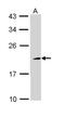 Nucleolysin TIA-1 antibody, NBP1-33452, Novus Biologicals, Western Blot image 