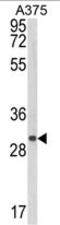 Collagen triple helix repeat-containing protein 1 antibody, AP17958PU-N, Origene, Western Blot image 