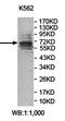 Zinc Finger Protein 98 antibody, orb78361, Biorbyt, Western Blot image 