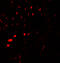 Aquaporin 2 antibody, 7621, ProSci, Immunofluorescence image 