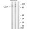 Cyclin Dependent Kinase 11B antibody, A11584, Boster Biological Technology, Western Blot image 