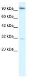 Aryl Hydrocarbon Receptor antibody, TA330210, Origene, Western Blot image 