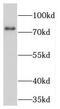 Transglutaminase 2 antibody, FNab08650, FineTest, Western Blot image 