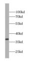 Protein Phosphatase 1 Catalytic Subunit Beta antibody, FNab06695, FineTest, Western Blot image 
