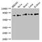 Forkhead Box K1 antibody, CSB-PA008824LA01HU, Cusabio, Western Blot image 