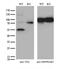 Protein TFG antibody, M02870-1, Boster Biological Technology, Western Blot image 