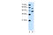 Zinc transporter ZIP5 antibody, 29-956, ProSci, Western Blot image 