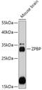 Zona Pellucida Binding Protein antibody, 18-013, ProSci, Western Blot image 