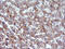 Vascular Endothelial Growth Factor B antibody, M04494, Boster Biological Technology, Immunohistochemistry paraffin image 