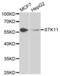 Serine/threonine-protein kinase 11 antibody, abx001734, Abbexa, Western Blot image 