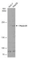 Plexin D1 antibody, GTX130372, GeneTex, Western Blot image 
