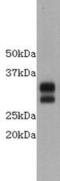 CD8 antibody, GTX37508, GeneTex, Western Blot image 