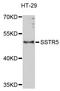 Somatostatin receptor type 5 antibody, LS-C332381, Lifespan Biosciences, Western Blot image 